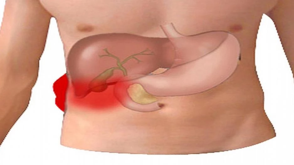 Πέτρες στη χολή: Υπάρχει λύση – Συμπτώματα, πρόληψη, αντιμετώπιση